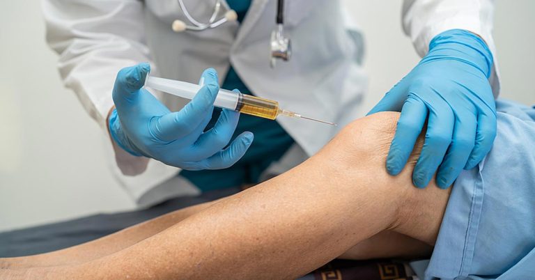 پی آر پی یا پلاکت درمانی چیست؟