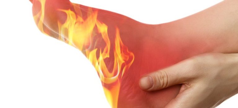 بالحرقان والألم في القدمين.