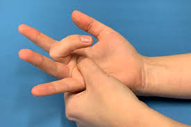 انگشت ماشهای