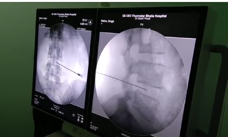 عملهای بسته دیسک