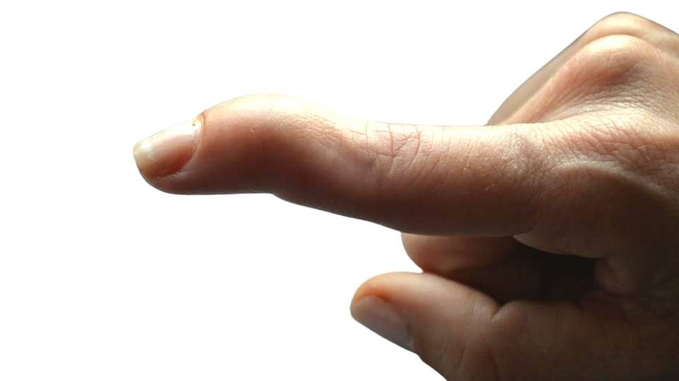 انگشت چکشی, درمان انگشت چکشی, علت انگشت چکشی, اصلاح انگشت چکشی, کفش مناسب برای انگشت چکشی, تمرینات کششی انگشت چکشی, ماساژ درمانی انگشت چکشی, درمان‌های طب فیزیکی و توانبخشی, اسپلینت انگشت چکشی, آرتروز انگشتان پا, درد انگشتان پا, مشکلات مفصلی پا, تغییر شکل انگشت پا, تمرینات اصلاحی پا, کفی طبی مخصوص, درمان دستی انگشت چکشی, طب سوزنی برای درد پا, التهاب انگشت پا, گرفتگی عضلات انگشتان, فیزیوتراپی انگشت چکشی