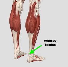 Achilles tendon shortening)